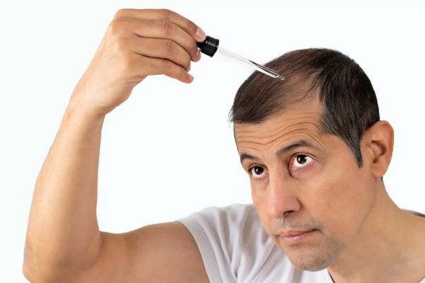 La greffe de cheveux